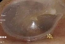 04a74c99fc2cbde14ad463e4691e9494.jpg 04a74c99fc2cbde14ad463e4691e9494.jpg